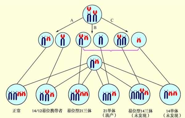 染色体异常